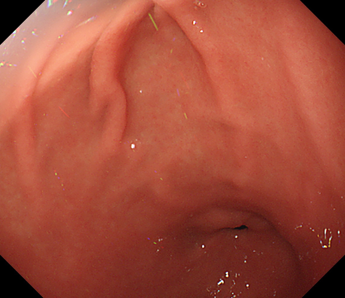 �H�啔���^